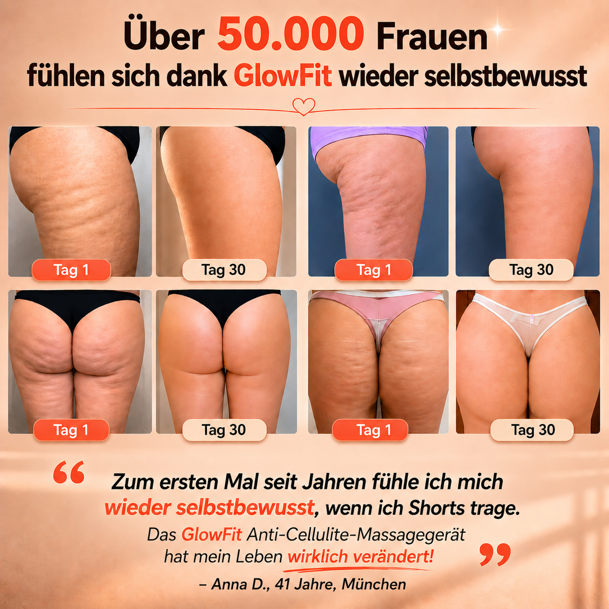 Über 50.000 Frauen haben sich für ELA entschieden · 30 Tage Garantie