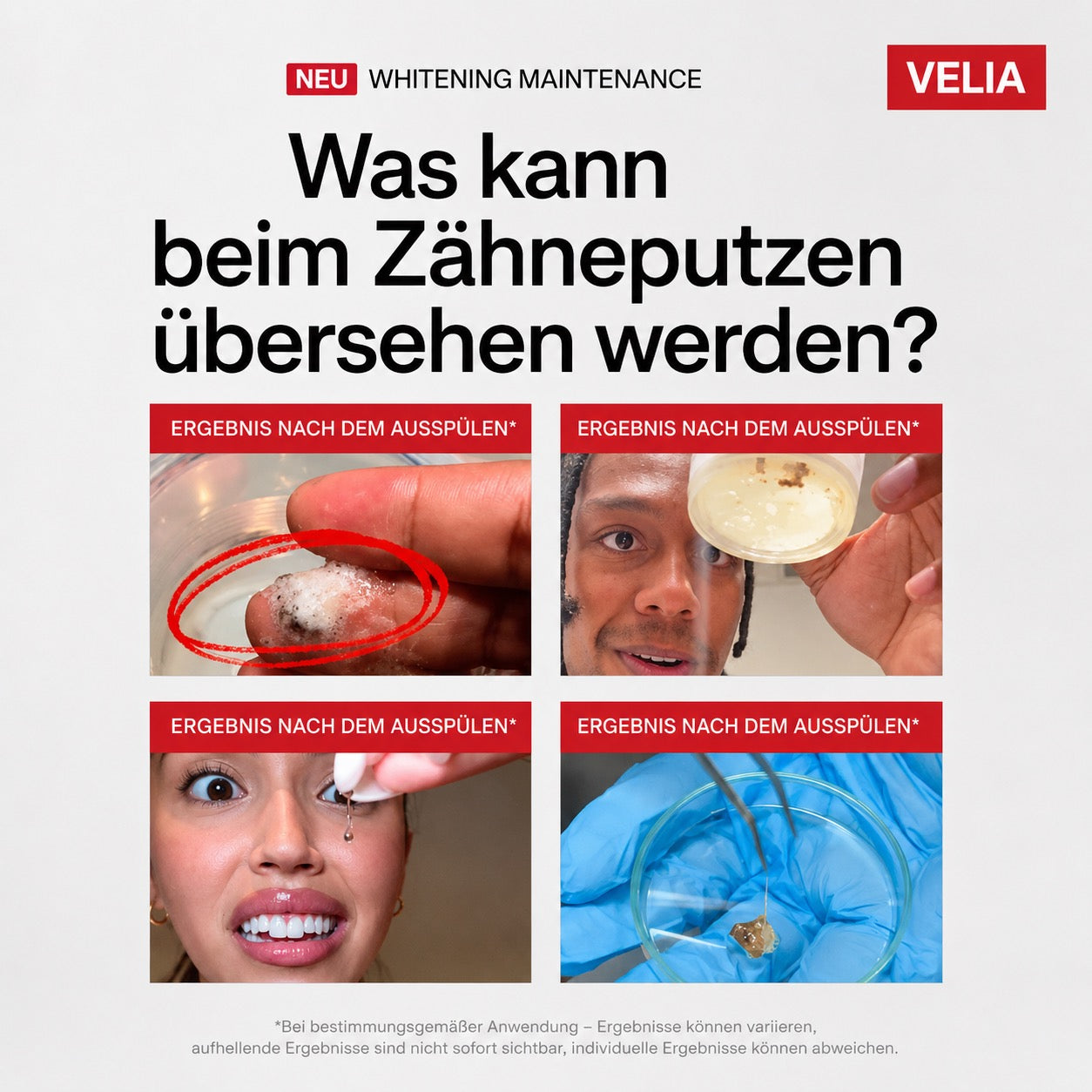 Was die Zahnbürste übersieht — sichtbarer Belag nach dem Spülen mit Velia